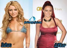 Is aubrey o'day going for a makeover? Aubrey O Day Plastic Surgery Before And After Photos Aubrey O Day Plastic Surgery Plastic Surgery Facts