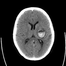 Pin On Cranial Ct