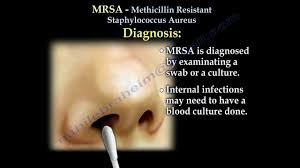 Where are mrsa and staph found? Mrsa Methicillin Resistant Saphylococcus Aureus Everything You Need To Know Dr Nabil Ebraheim Youtube