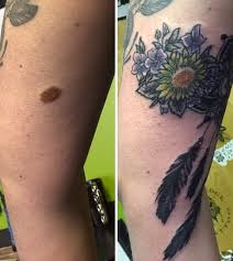 Birthmark Cover Up Tattoo Pin On Tattoo