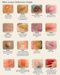 Pin By Dr Swismin Gems On Basic Medical Knowledge Dermatology Nurse Wound Care Nursing Wound Care