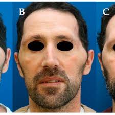 Daniel Schmauss's research works