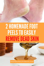 diy foot l dead skin removal say
