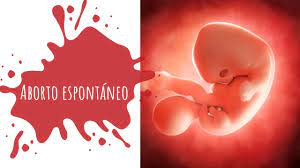 Aborto Espontaneo Causas Sintomas Tipos De Aborto Y Tratamiento Youtube