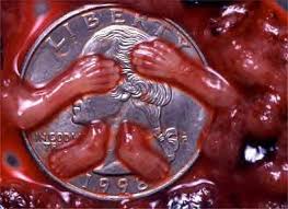 Image result for abortion