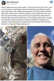 Famed Alpinist Barry Blanchard Overcomes Brain Injury to Climb Again