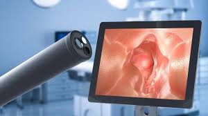 Image result for Colon Cancer Screening with Colonoscopy