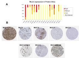 Die lymphe ist anfangs ähnlich wie die gewebsflüssigkeit zusammengesetzt, aus der sie sich bildet. Cancers Free Full Text Unsupervised Hierarchical Clustering Of Pancreatic Adenocarcinoma Dataset From Tcga Defines A Mucin Expression Profile That Impacts Overall Survival Html