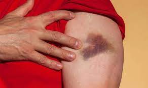 Stomach cancer begins when cancer cells form in the inner lining of your stomach.these cells can grow into a tumor. Blood Cancer Symptoms Commonly Ignored Signs Of Acute Leukaemia Express Co Uk
