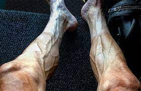 7 Remedios Para Piernas Cansadas