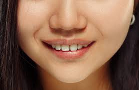 Can Invisalign Fix A Snaggletooth? - Quora