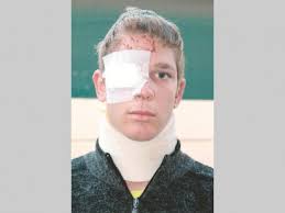 Beseerdes herroep ongeluk gebeure