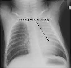 Rd.com knowledge facts you might think that this is a trick science trivia question. Radiology Test 1 Proprofs Quiz