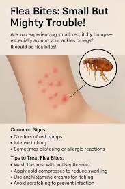 Image result for flea bites