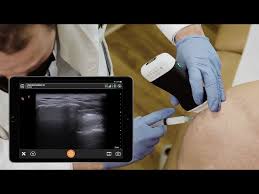 Image result for Subacromial Space Injection