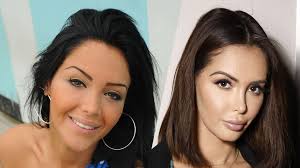 Signification, origine, date de fête de la sainte nabilla, caractère, popularité et avis. Nabilla Et Chirurgie Esthetique Elle Devoile La Verite Clinique Aram