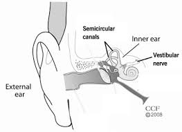 Meniere S Disease Causes Symptoms Diagnosis Treatment