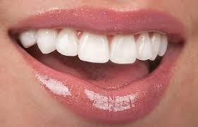 Check spelling or type a new query. How Durable Are Porcelain Veneers Durability Of Veneers In Manhattan Nyc