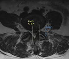 Image result for Low Back Imaging