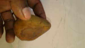 Batu empedu yang meyumbat saluran empedu berasal dari koresterol. Batu Petir Kuning Youtube