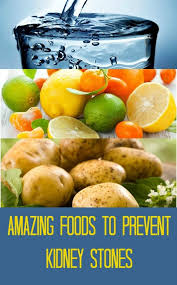Kidney Stones Diet Foods List Benefits And Lifestyle Changes Kidney Stone Diet Low Oxalate Diet Food