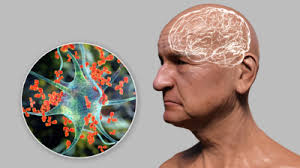 Michelle Yumi Ishida Rodrigues, Autor em MDHealth