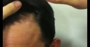 Hairback Sac Ekimi Merkezi Incoming Call Screenshot