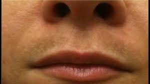 By continued use, you agree to our privacy policy and accept our use of such cookies. How To Get Rid Of Upper Lip Discoloration Youtube Upper Lip Hair Dark Spots On Skin Lip Hyperpigmentation