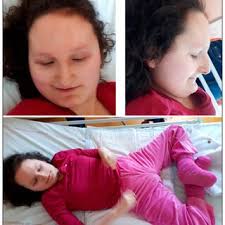 PDF) New Insights into Potocki-Shaffer Syndrome: Report of Two Novel Cases  and Literature Review