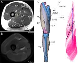 A magnetic resonance imaging (mri) was performed on a normal subject; In Vivo Human Lower Limb Muscle Architecture Dataset Obtained Using Diffusion Tensor Imaging