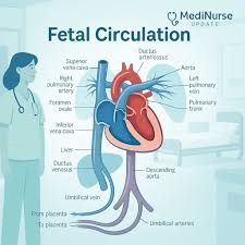 Image result for Delayed Transition from Fetal Circulation
