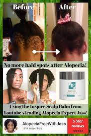 Inspire Scalp Balm Alopecia Free Shop Hair Growth Treatment Natural Hair Styles Promote Healthy Hair Growth