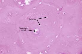 A section of monkey femoral midshaft cortical bone showing endosteal and intracortical bone calcein labels as seen under fluorescence microscopy. Description