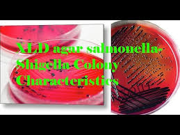 Salmonella shigella agar comprises of bile salts, sodium citrate, brilliant green, enzymatic digest of casein, beef extract, enzymatic digest of animal tissue, thiosulphate, ferric citrate, neutral red and agar. Xld Agar Salmonella Shigella Colony Characteristics Xylose Lysine Deoxycholate Agar Youtube