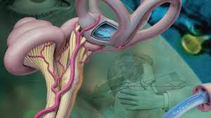 Severe Dizziness Nausea And Vomiting Prompt An Ed Visit Clinical Advisor