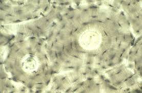 A cross section of any bone will demonstrate these two types of bones. Normal Histology