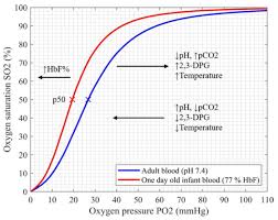 Image result for Delayed Transition from Fetal Circulation