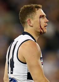 North veteran Brent Harvey will fight one-game ban