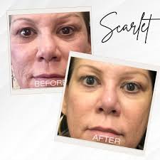 At Dr. John Rohm's practice, personalized care goes beyond just routine  checkups. By taking the time to truly connect with each patient, Dr. Rohm  gains a deeper understanding of your unique oral