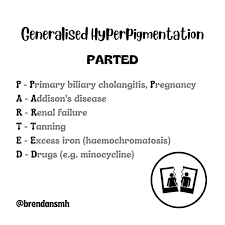 Image result for Diffuse Hyperpigmentation