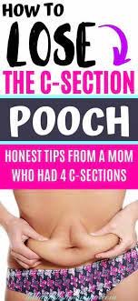 How To Lose The C-Section Pooch - Italianpolishmomma.com