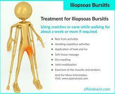 Iliopsoas Bursitis Or Iliopectineal Bursitis Iliopsoas Bursitis Bursitis Trochanteric Bursitis Treatment