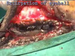 Image result for eyeball enucleation cattle