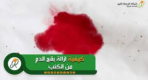 ازالة بقع الدم من الكنب بطرق سهله وسريعة شركة تنظيف كنب بحفر الباطن