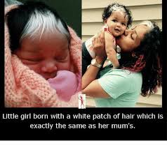 Little bence was born with a unique and beautiful white hair. Little Girl Born With A White Patch Of Hair Which Is Exactly The Same As Her Mum S Meme On Me Me