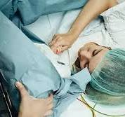 What Happens During a C-Section Procedure?