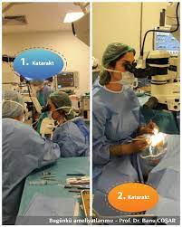 Katarakt Ameliyatinin Mevsimi Yoktur Yaz Mevsiminde Katarakt Olundugunda Da 10 Gun Sonra Denize Girilebilir Katarakt Cataracts Fako Phaco Ordu Ikiz Yaz