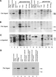 Long-Term and Therapeutic-Level Hepatic Gene Expression of Human Factor IX  after Naked Plasmid Transfer in Vivo