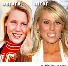The Oc Gretchen Real Housewives Plastic Surgery Reality Tv