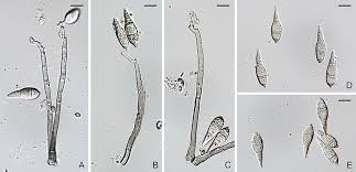 Image result for Pycnospora